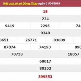 dự đoán kết quả xổ số đồng nai