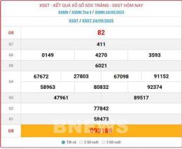 tính năng nổi bật soi cầu xổ số sóc trăng
